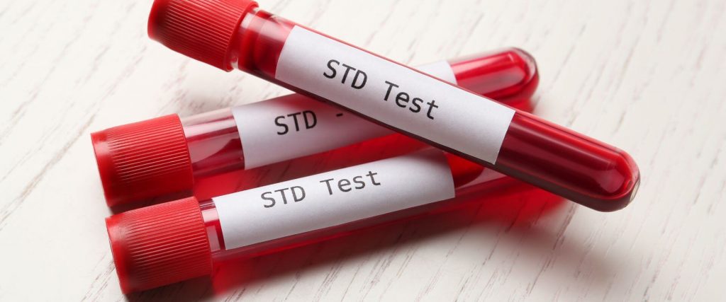 STD tests covered by Medicare - image
